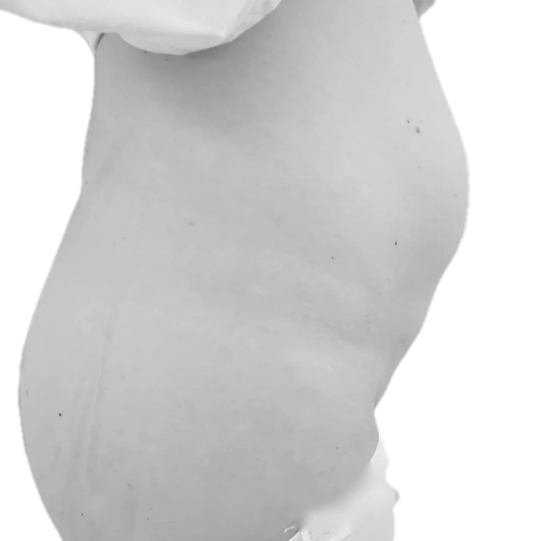 Bukplastik – före