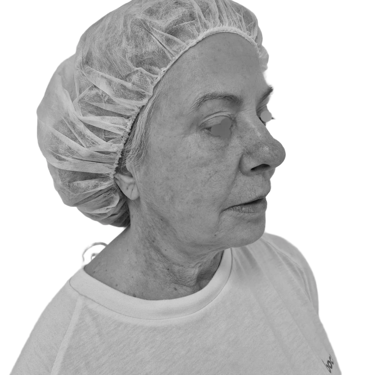 Ansiktslyft – före