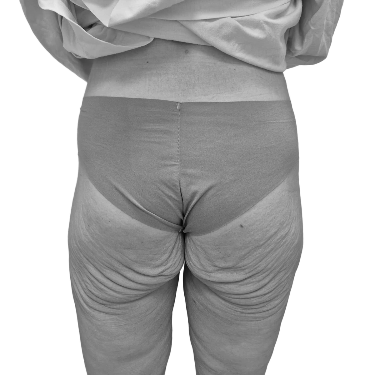 Stusslyft – före